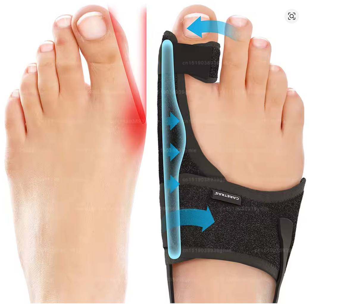 Bunion Corrector Splint ~ Big Toe Straightener with Aluminium Bar, One Size, Black